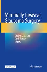 Cover von Minimally Invasive Glaucoma Surgery