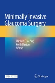 Cover von Minimally Invasive Glaucoma Surgery