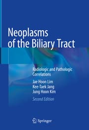 Cover von Neoplasms of the Biliary Tract