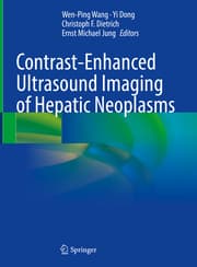 Cover von Contrast-Enhanced Ultrasound Imaging of Hepatic Neoplasms