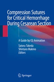 Cover von Compression Sutures for Critical Hemorrhage During Cesarean Section
