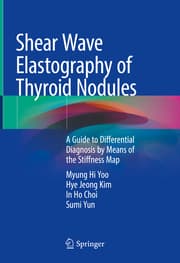 Cover von Shear Wave Elastography of Thyroid Nodules