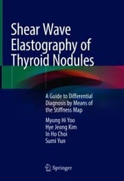 Cover von Shear Wave Elastography of Thyroid Nodules
