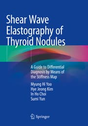 Cover von Shear Wave Elastography of Thyroid Nodules