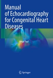Cover von Manual of Echocardiography for Congenital Heart Diseases