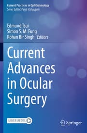 Cover von Current Advances in Ocular Surgery