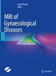 Cover von MRI of Gynaecological Diseases