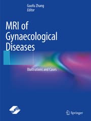 Cover von MRI of Gynaecological Diseases