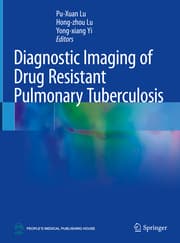 Cover von Diagnostic Imaging of Drug Resistant Pulmonary Tuberculosis