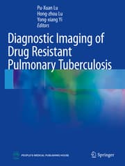 Cover von Diagnostic Imaging of Drug Resistant Pulmonary Tuberculosis