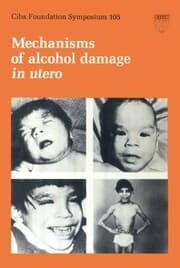 Cover von Mechanisms of Alcohol Damage in Utero