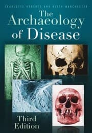 Cover von The Archaeology of Disease