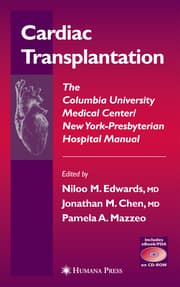 Cover von Cardiac Transplantation