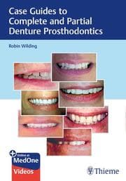Cover von Case Guides to Complete and Partial Denture Prosthodontics