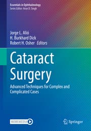 Cover von Cataract Surgery