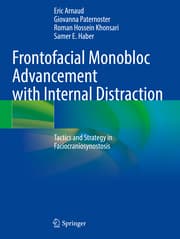Cover von Frontofacial Monobloc Advancement with Internal Distraction