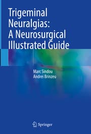 Cover von Trigeminal Neuralgias: A Neurosurgical Illustrated Guide