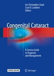 Cover von Congenital Cataract