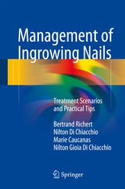Cover von Management of Ingrowing Nails
