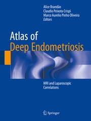 Cover von Atlas of Deep Endometriosis