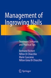 Cover von Management of Ingrowing Nails