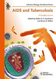 Cover von AIDS and Tuberculosis