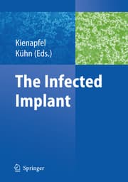 Cover von The Infected Implant
