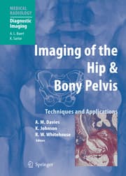 Cover von Imaging of the Hip & Bony Pelvis
