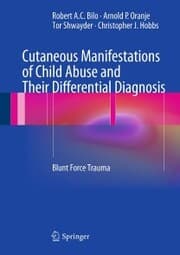 Cover von Cutaneous Manifestations of Child Abuse and Their Differential Diagnosis