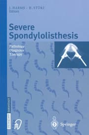 Cover von Severe Spondylolisthesis