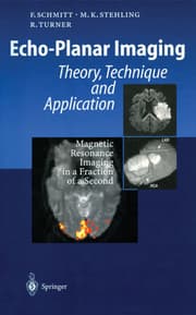 Cover von Echo-Planar Imaging