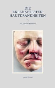 Cover von Die ekelhaftesten Hautkrankheiten
