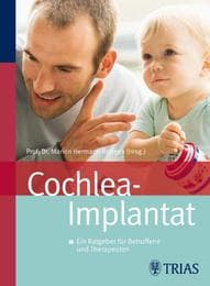 Cover von Cochlea-Implantat