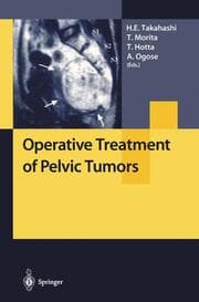Cover von Operative Treatment of Pelvic Tumors